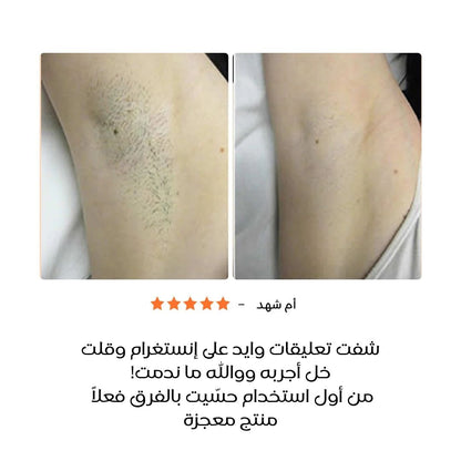 إبيفي كريم لإزالة الشعر